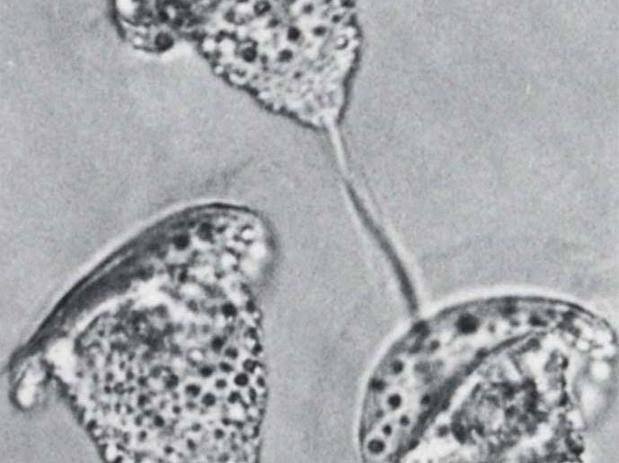 Pseudovorticella monilata